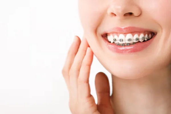 Orthodontic Treatment