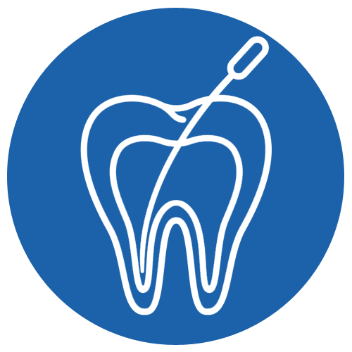 Root Canal Treatment